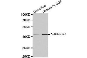 Western blot analysis of extracts from PC14 cells using phospho-JUN-S73 antibody. (C-JUN antibody  (pSer73))