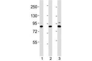 Western Blotting (WB) image for anti-SUZ12 Polycomb Repressive Complex 2 Subunit (SUZ12) (AA 381-395) antibody (ABIN3029058)