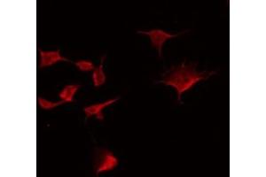 ABIN6275124 staining NIH-3T3 by IF/ICC. (Fibulin 5 antibody  (C-Term))