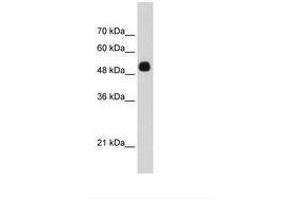 Image no. 2 for anti-Cyclin D Binding Myb-Like Transcription Factor 1 (DMTF1) (AA 626-675) antibody (ABIN6736296) (DMP1 antibody  (AA 626-675))