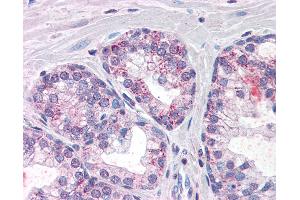 Anti-PDE11A antibody IHC of human prostate. (PDE11A antibody  (AA 455-468))