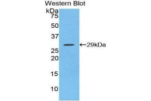 Western Blotting (WB) image for anti-Fibroblast Growth Factor Receptor 2 (FGFR2) (AA 157-377) antibody (ABIN3206051) (FGFR2 antibody  (AA 157-377))