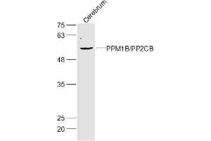 Mouse cerebrum lysates probed with Gliomedin Polyclonal Antibody, Unconjugated  at 1:300 dilution and 4˚C overnight incubation. (GLDN antibody  (AA 365-460))