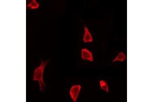 ABIN6267646 staining HeLa by IF/ICC. (Cortactin antibody  (pTyr466))
