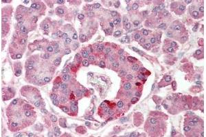 Human Pancreas: Formalin-Fixed, Paraffin-Embedded (FFPE) (PHLPP1 antibody  (N-Term))