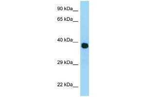 WB Suggested Anti-MRPL3 Antibody Titration: 1. (MRPL3 antibody  (N-Term))