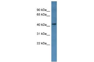 WB Suggested Anti-MAGEA11 Antibody Titration: 0. (MAGEA11 antibody  (Middle Region))