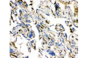 IHC analysis of ACE using anti-ACE antibody (ABIN3043777). (Angiotensin I Converting Enzyme 1 antibody  (AA 651-864))