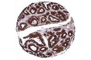 thyroid gland (Recombinant Thyroglobulin antibody)