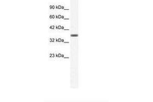 Image no. 1 for anti-Annexin A3 (ANXA3) (C-Term) antibody (ABIN202242) (Annexin A3 antibody  (C-Term))