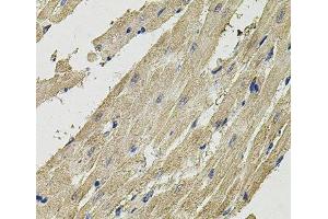Immunohistochemistry of paraffin-embedded Rat heart using SMN2 Polyclonal Antibody (SMN2 antibody)