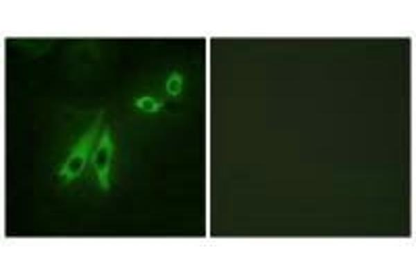 AKAP3 antibody
