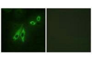Immunofluorescence analysis of NIH/3T3 cells, using AKAP3 antibody. (AKAP3 antibody)