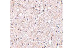 Immunohistochemistry of BRSK2 in human brain tissue with BRSK2 polyclonal antibody  at 5 ug/mL . (BRSK2 antibody  (C-Term))