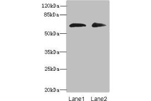 Western blot All lanes: ZNF529 antibody at 6 μg/mL Lane 1: Hela whole cell lysate Lane 2: MCF-7 whole cell lysate Secondary Goat polyclonal to rabbit IgG at 1/10000 dilution Predicted band size: 66 kDa Observed band size: 66 kDa
