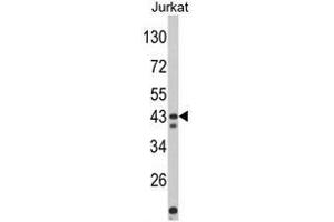 Western blot analysis of CECR5 Antibody (Center) in Jurkat cell line lysates (35ug/lane). (CECR5 antibody  (Middle Region))