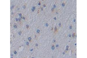 Used in DAB staining on fromalin fixed paraffin- embedded Kidney tissue (IL1RAPL1 antibody  (AA 113-276))