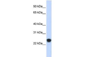 WB Suggested Anti-FKBAntibody Titration:  0. (FKBP11 antibody  (N-Term))