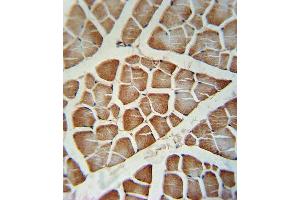Immunohistochemistry (Paraffin-embedded Sections) (IHC (p)) image for anti-Cytochrome P450, Family 2, Subfamily J, Polypeptide 2 (CYP2J2) (AA 156-183) antibody (ABIN391655)