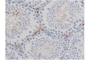 ABIN6267467 at 1/200 staining Mouse testis tissue sections by IHC-P. (CDC25B antibody  (pSer323))