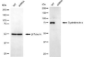 Western blotting analysis using dystrobrevin alpha antibody (ABIN7798410). (DTNA antibody)