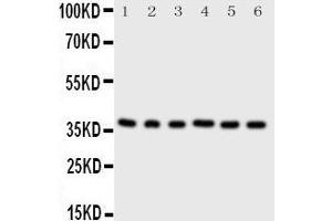 Western Blotting (WB) image for anti-Cyclin-Dependent Kinase 7 (CDK7) (AA 329-346), (C-Term) antibody (ABIN3042892) (CDK7 antibody  (C-Term))