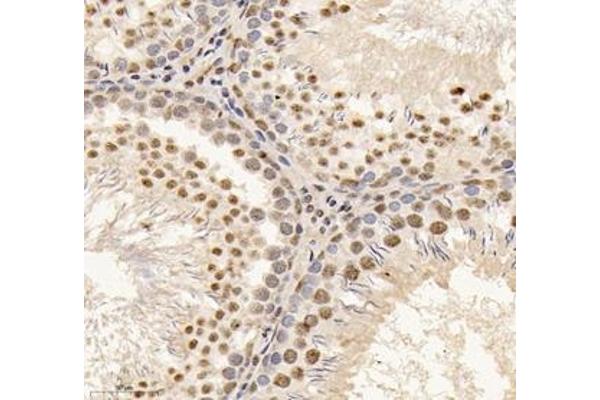 PABPN1 antibody