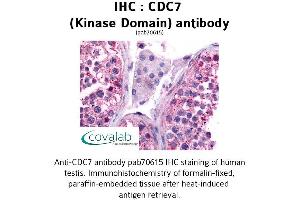 Image no. 1 for anti-Cell Division Cycle 7 (CDC7) antibody (ABIN1732913) (CDC7 antibody)