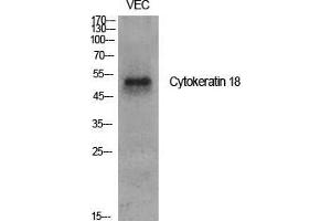 Western Blot (WB) analysis of specific cells using Cytokeratin 18 Polyclonal Antibody. (Cytokeratin 18 antibody  (Ser726, Ser731))