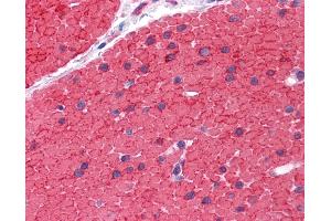 Immunohistochemistry (IHC) image for anti-Low Density Lipoprotein Receptor Adaptor Protein 1 (LDLRAP1) (AA 1-264) antibody (ABIN574448)