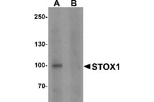 Western blot analysis of STOX1 in human liver tissue lysate with STOX1 antibody at 1 µg/mL in (A) the absence and (B) the presence of blocking peptide.