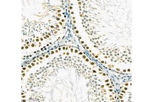 Immunohistochemistry (Paraffin-embedded Sections) (IHC (p)) image for anti-Stem-Loop Binding Protein (SLBP) antibody (ABIN7075733)