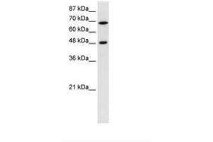 Image no. 1 for anti-Ribosomal RNA Processing 9, Small Subunit (SSU) Processome Component, Homolog (RRP9) (AA 184-233) antibody (ABIN202618) (RRP9 antibody  (AA 184-233))