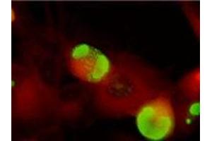 Immunofluorescence (IF) image for anti-ICP36 DNA Binding Protein (CMV ICP36) antibody (ABIN265542) (ICP36 DNA Binding Protein (CMV ICP36) antibody)