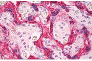 Image no. 1 for anti-CGA / hCG alpha antibody (ABIN1502310) (CGA / hCG alpha antibody)