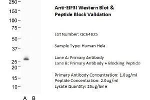 Host: Rabbit Target Name: EIF3I Sample Type: Human Hela  Lane A: Primary Antibody  Lane B: Primary Antibody + Blocking Peptide  Primary Antibody Concentration: 1.