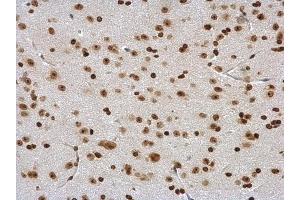 IHC-P Image DDX56 antibody detects DDX56 protein at nucleus in mouse brain by immunohistochemical analysis. (DDX56 antibody  (Center))