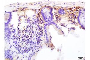 Formalin-fixed and paraffin embedded mouse colon labeled with Anti-CD13/APN/ANPEN Polyclonal Antibody, Unconjugated (ABIN685762) at 1:200 followed by conjugation to the secondary antibody and DAB staining. (CD13 antibody  (AA 344-444))