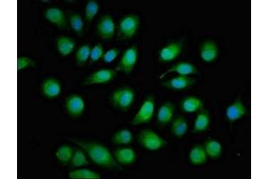 Immunofluorescent analysis of A549 cells using ABIN7166191 at dilution of 1:100 and Alexa Fluor 488-congugated AffiniPure Goat Anti-Rabbit IgG(H+L) (Protein Tob1 (TOB1) (AA 42-175) antibody)