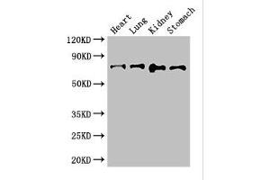 Western Blot Positive WB detected in: Mouse heart tissue, Mouse lung tissue, Mouse kidney tissue, Mouse stomach tissue All lanes: ABCG8 antibody at 2.