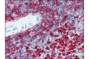 Immunohistochemistry (IHC) image for anti-Integrin beta 2 (ITGB2) antibody (ABIN614281) (Integrin beta 2 antibody)
