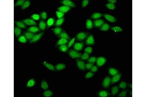 Immunofluorescence staining of Hela cells with ABIN7164161 at 1:166, counter-stained with DAPI. (PRPF8 antibody  (AA 2037-2170))