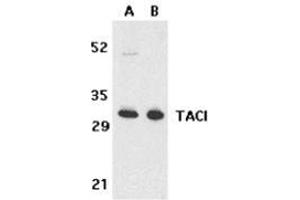Western blot analysis of TACI in K562 (A) and U937 (B) cell lysates with this product at 5 μg/ml.