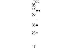 Western blot analysis of DDX5 antibody (C-term) in T47D cell line lysates (35ug/lane). (DDX5 antibody  (C-Term))