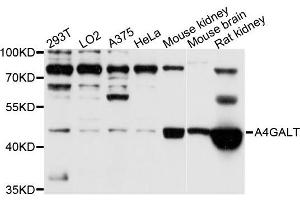 Western blot analysis of extracts of various cell lines, using A4GALT antibody (ABIN5995923) at 1/1000 dilution. (A4GALT antibody)