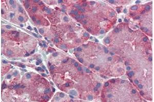 Human, Stomach: Formalin-Fixed Paraffin-Embedded (FFPE) (ERP44 antibody  (C-Term))