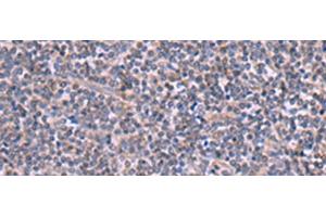 Immunohistochemistry of paraffin-embedded Human tonsil tissue using RIC3 Polyclonal Antibody at dilution of 1:90(x200) (RIC3 antibody)