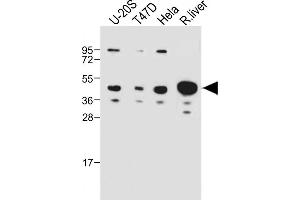 All lanes : Anti-IDAS Antibody (N-term) at 1:1000 dilution Lane 1: U-20S whole cell lysate Lane 2: T47D whole cell lysate Lane 3: Hela whole cell lysate Lane 4: Rat liver whole cell lysate Lysates/proteins at 20 μg per lane. (Multicilin antibody  (N-Term))