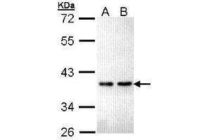 WB Image Sample (30 ug of whole cell lysate) A: Hela B: Hep G2 , 12% SDS PAGE antibody diluted at 1:5000 (ZNF346 antibody)
