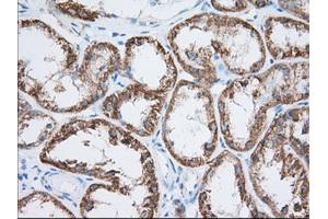Immunohistochemical staining of paraffin-embedded Human Kidney tissue using anti-HIBCH mouse monoclonal antibody. (HIBCH antibody)